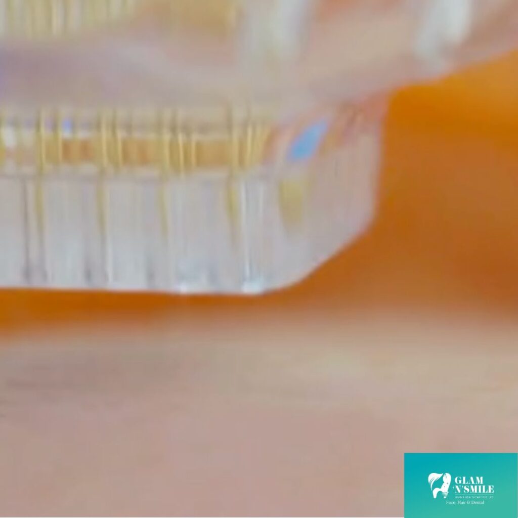 Microneedling Facial Treatment