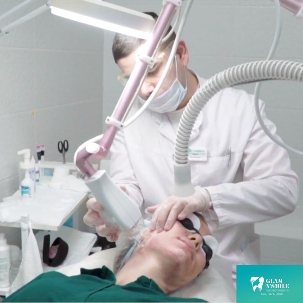 Fractional Co2 Laser Facial Treayment